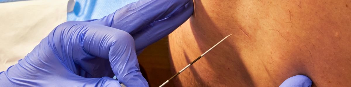 Intrathecal and Epidural Therapies Dubai