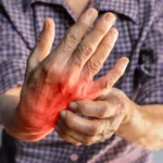 Nerve Pain Symptoms